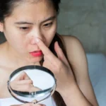 jerawat di dalam hidung