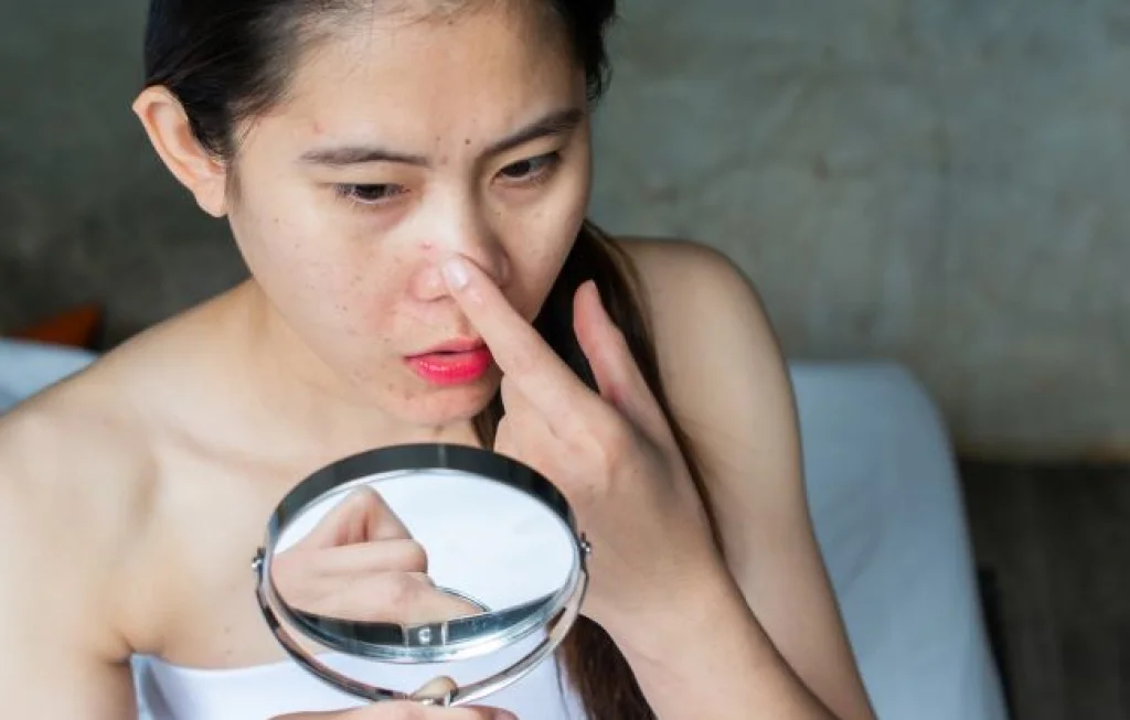 jerawat di dalam hidung