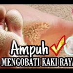 obat kaki rayapan ampuh